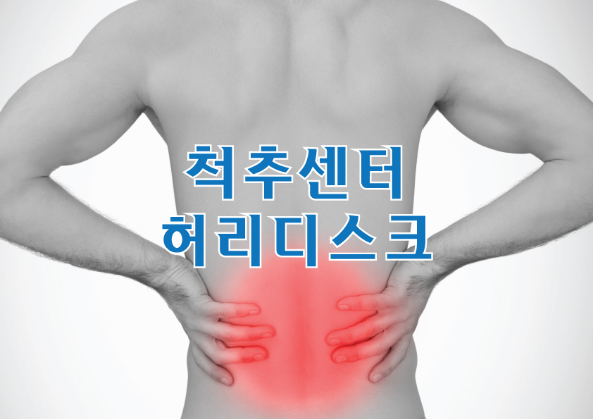 척추센터 - 허리디스크